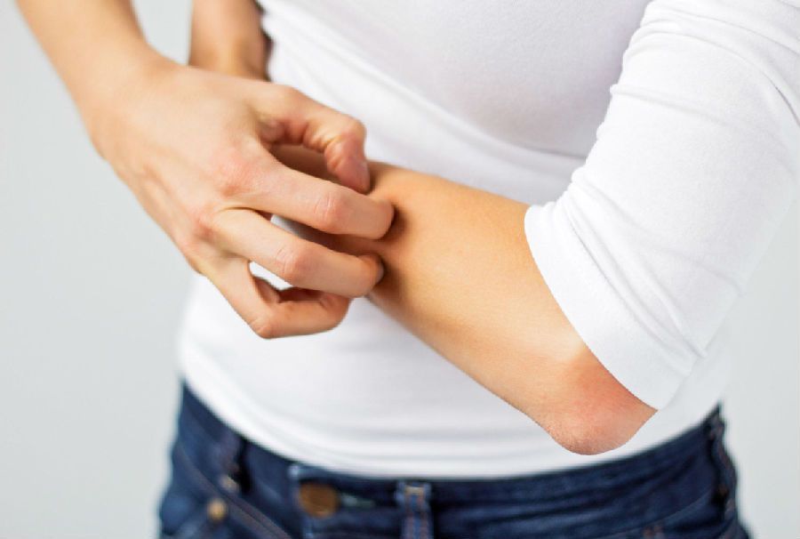 7 consejos para tratar los brotes de dermatitis atópica